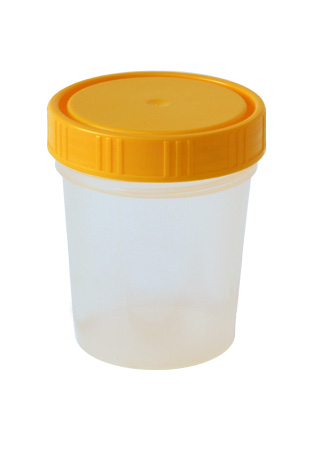 Varroa Schüttelbecher